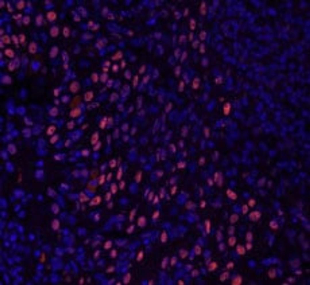 Detection of human GTF2I/TFII-I by immunohistochemistry.