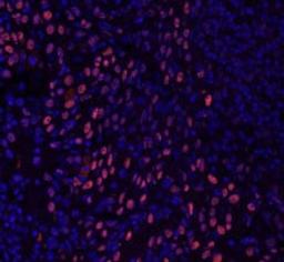 Detection of human GTF2I/TFII-I by immunohistochemistry.