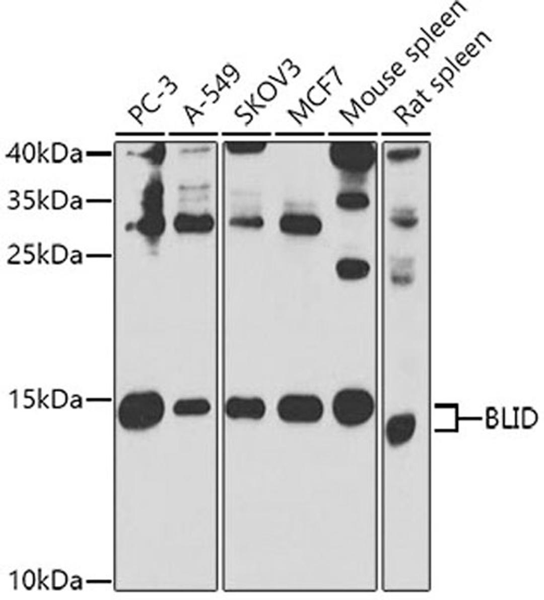 Western blot - BLID antibody (A7275)