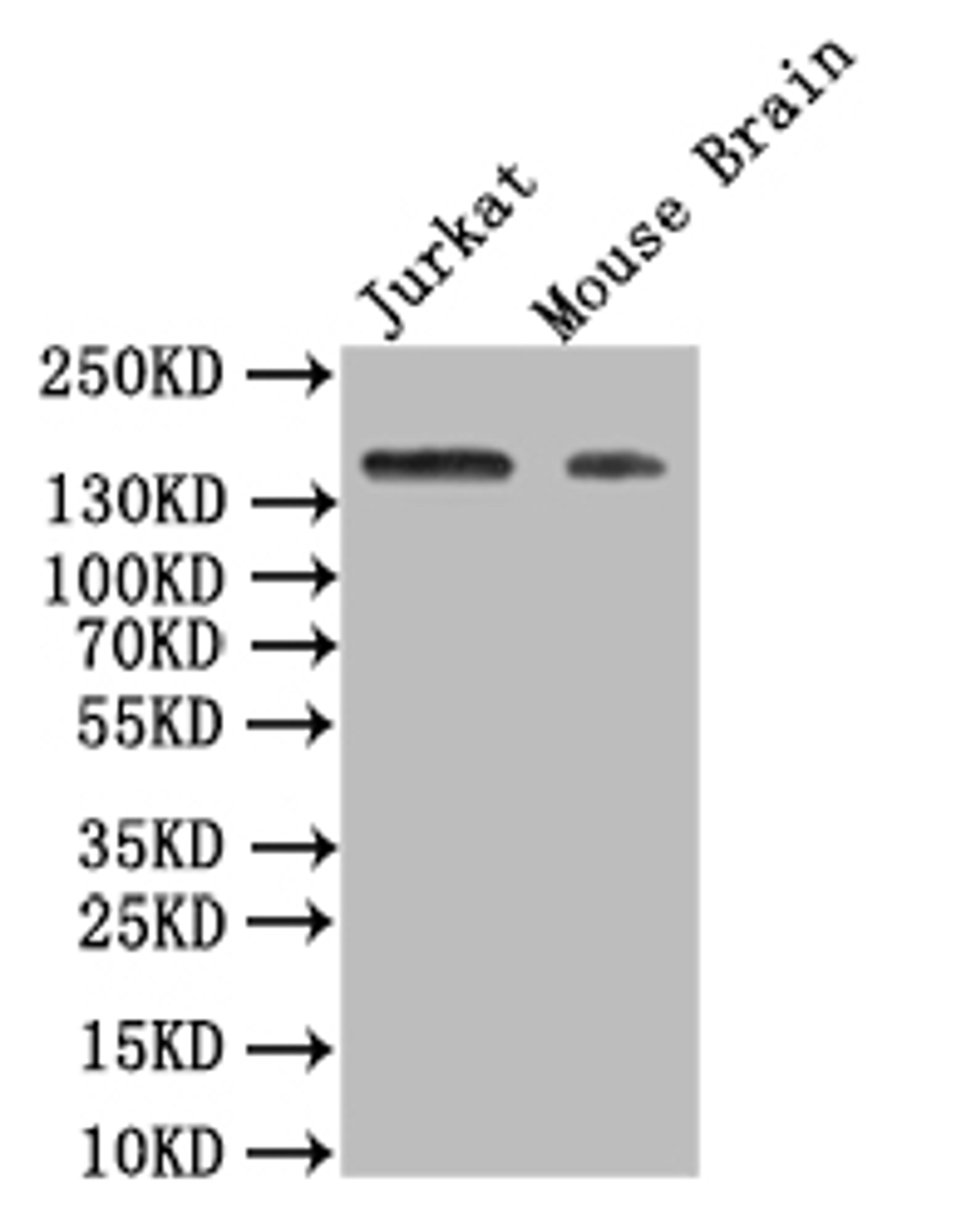 Western Blot. Positive WB detected in: JK whole cell lysate, Mouse Brain tissue lysate. All lanes: VEGF Receptor 1 antibody at 1:500. Secondary. Goat polyclonal to rabbit IgG at 1/50000 dilution. Predicted band size: 150 kDa. Observed band size: 150 kDa. 