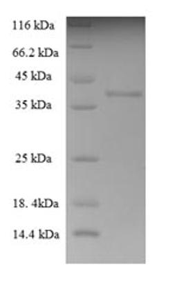 (Tris-Glycine gel) Discontinuous SDS-PAGE (reduced) with 5% enrichment gel and 15% separation gel.