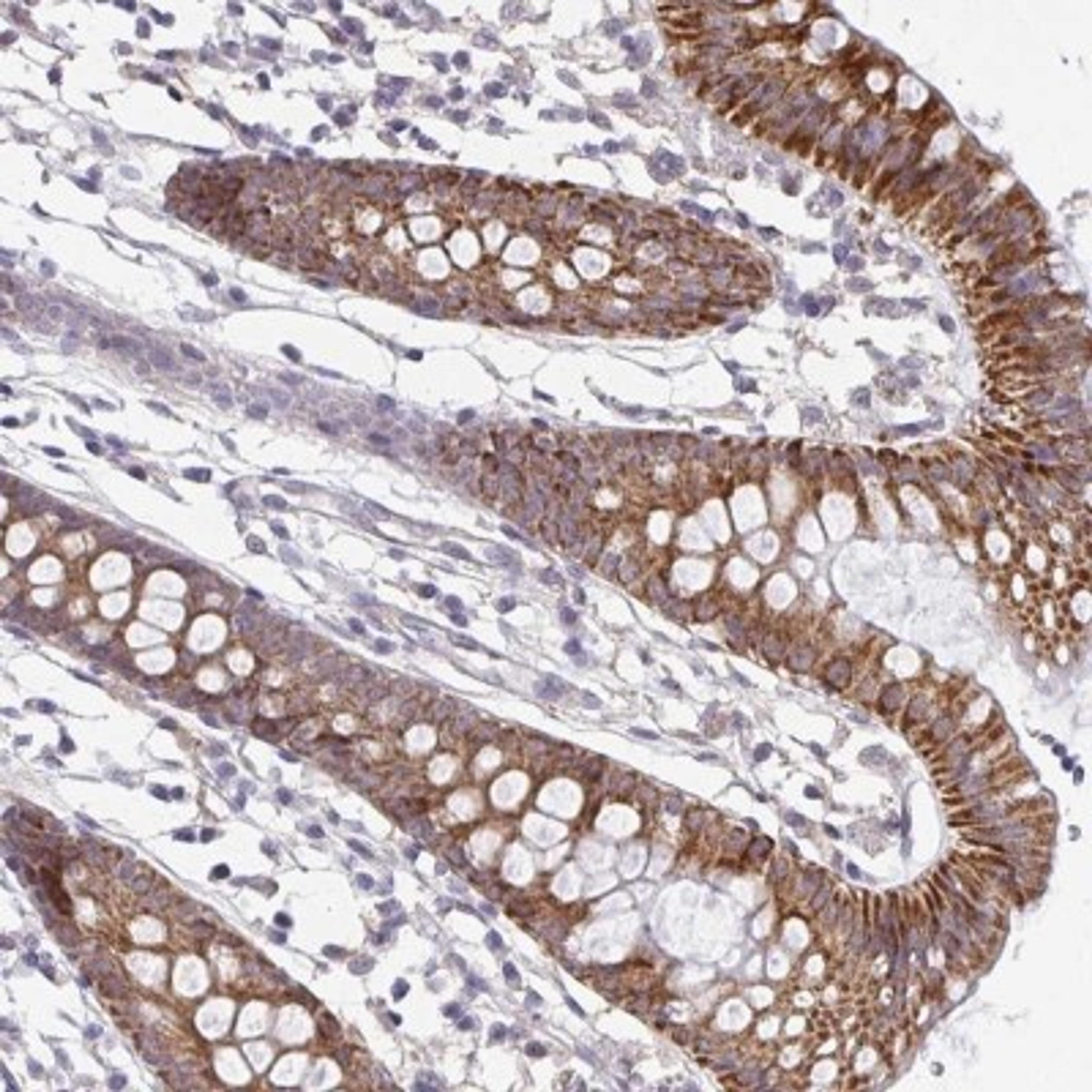 Immunohistochemistry-Paraffin: PSMB11 Antibody [NBP2-34158] - Immunohistochemical staining of human colon shows strong cytoplasmic positivity in glandular cells.