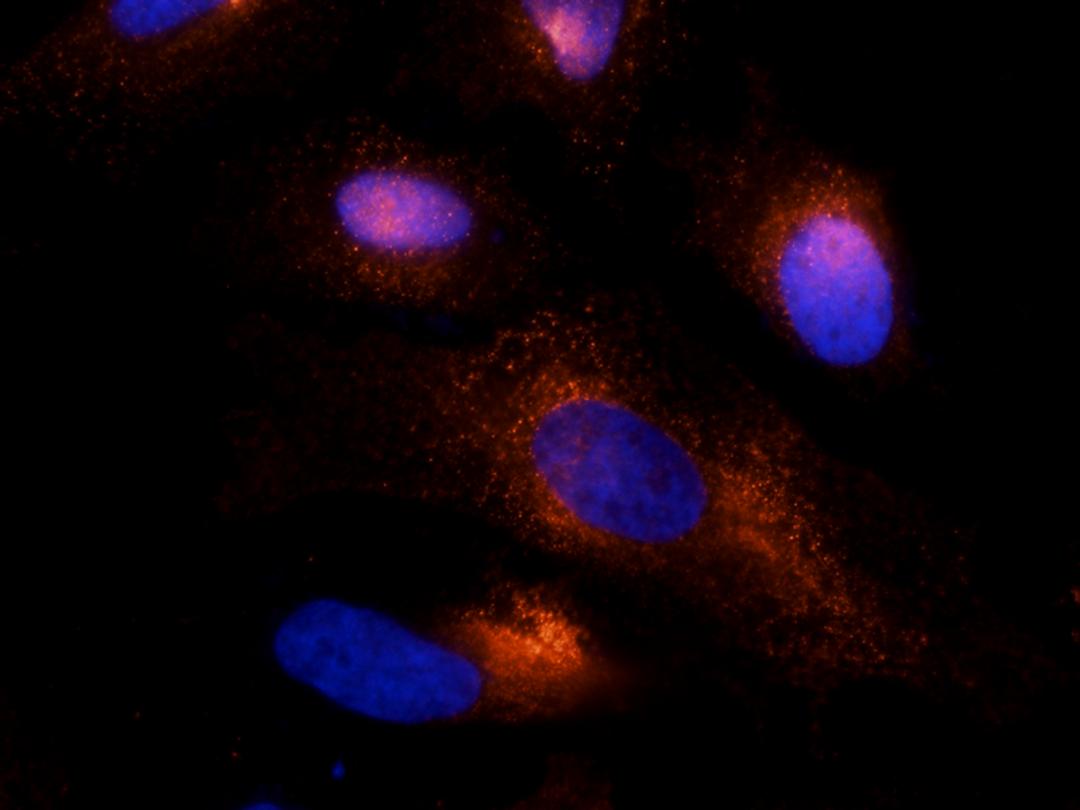 Immunofluorescence image of human hela cells tissue using PLK4 antibody (dilution at 2.5 ug/ml)