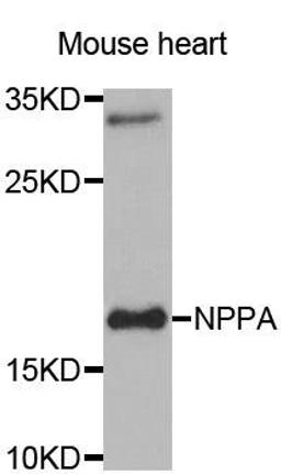 Western blot analysis of extracts of Mouse heart tissue using NPPA antibody