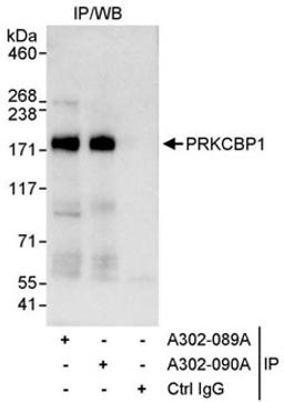 Detection of human PRKCBP1 by western blot of immunoprecipitates.