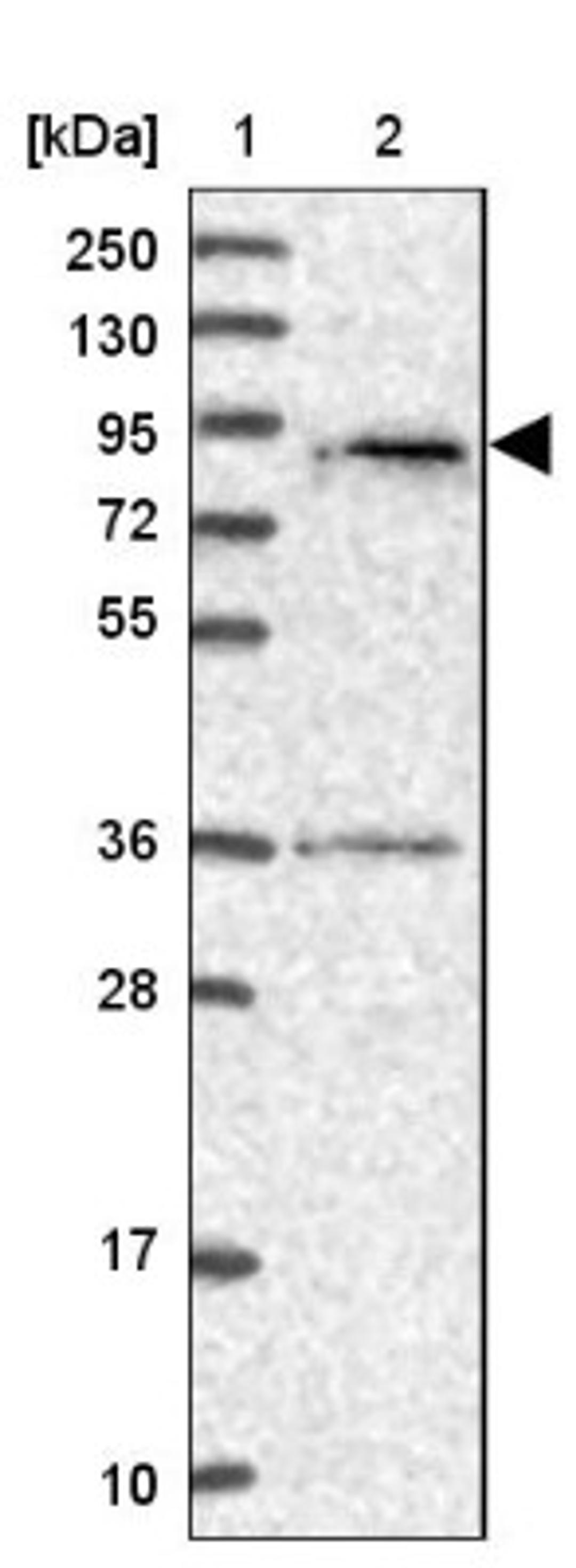 Western Blot: SPATA5L1 Antibody [NBP1-92430] - Lane 1: Marker [kDa] 250, 130, 95, 72, 55, 36, 28, 17, 10<br/>Lane 2: Human cell line RT-4