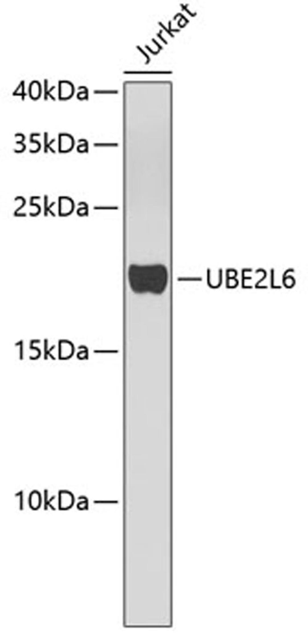 Western blot - UBE2L6 antibody (A4282)