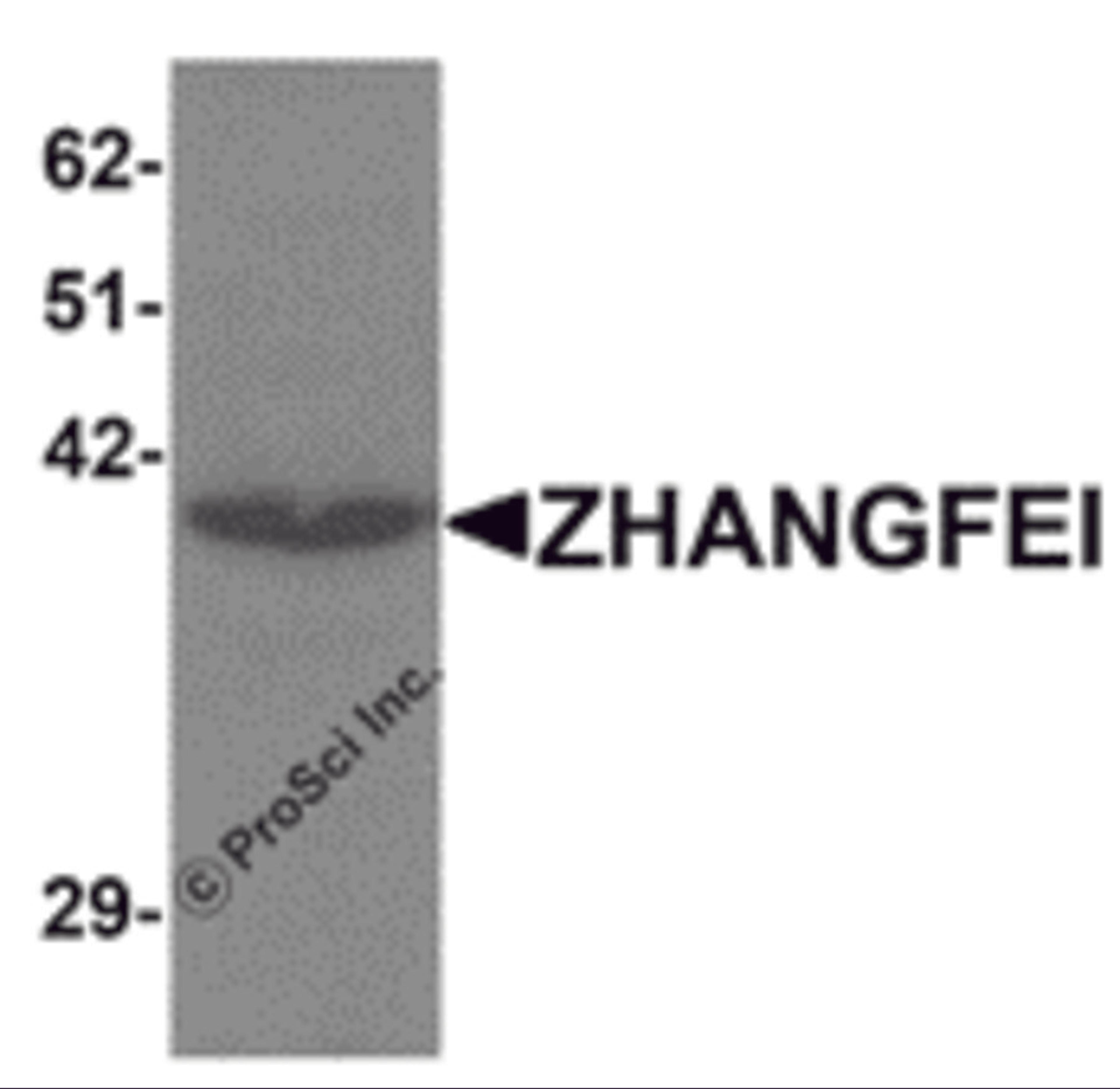 Western blot analysis of ZHANGFEI in K562 cell lysate with ZHANGFEI antibody at 1 &#956;g/mL.