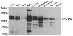 Western blot analysis of extracts of various cell lines using ANKRD52 antibody