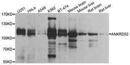 Western blot analysis of extracts of various cell lines using ANKRD52 antibody