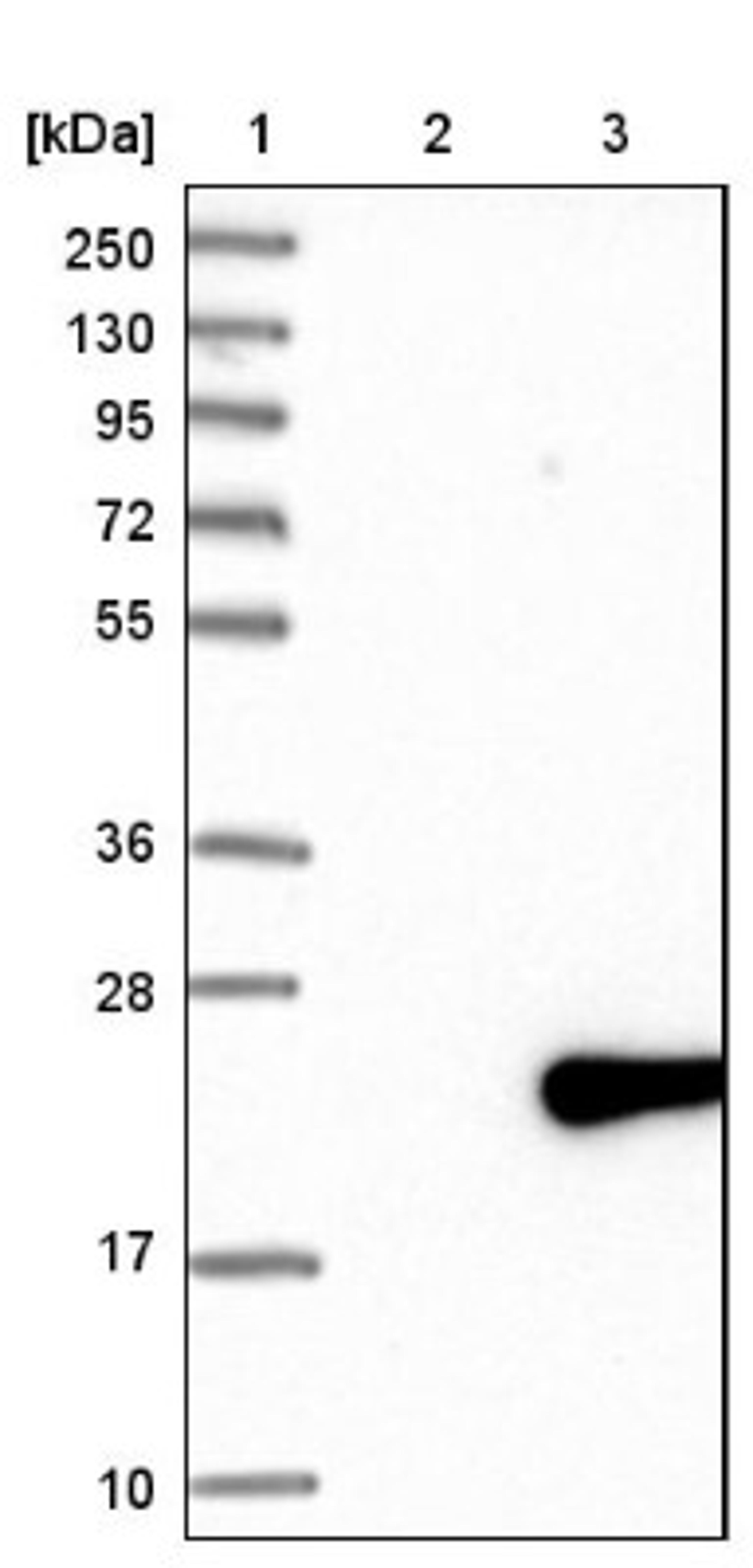 Western Blot: MED21 Antibody [NBP1-87006] - Lane 1: Marker [kDa] 250, 130, 95, 72, 55, 36, 28, 17, 10<br/>Lane 2: Negative control (vector only transfected HEK293T lysate)<br/>Lane 3: Over-expression lysate (Co-expressed with a C-terminal myc-DDK tag (~3.1 kDa) in mammalian HEK293T cells, LY418106)