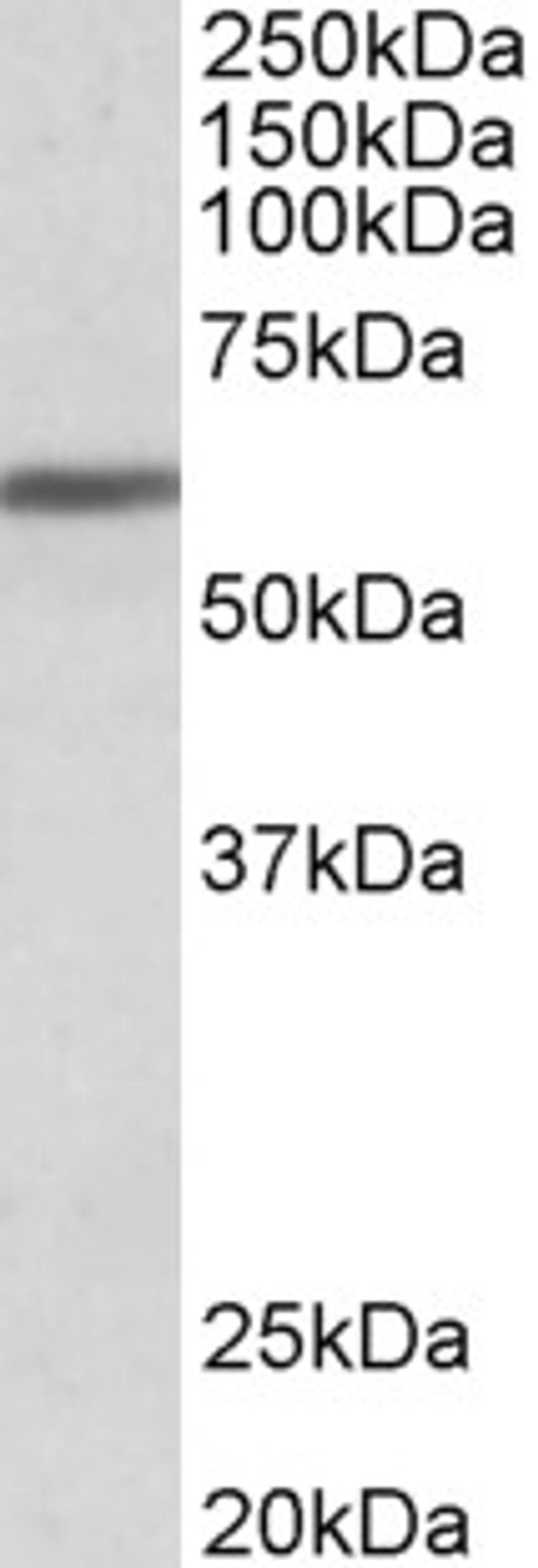 46-618 (1ug/ml) staining of Human Breast cancer lysate (35ug protein in RIPA buffer). Primary incubation was 1 hour. Detected by chemiluminescence.