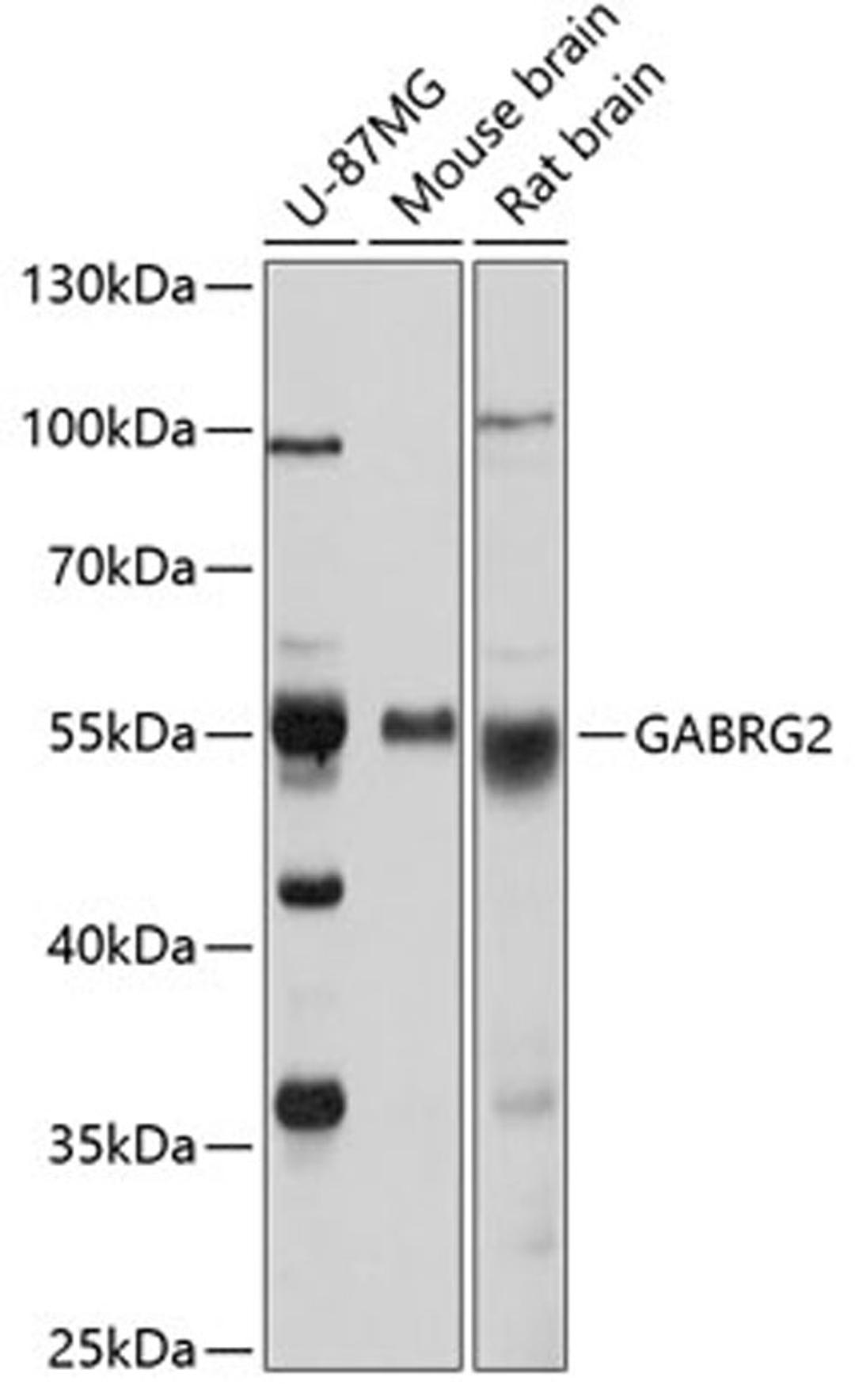 Western blot - GABRG2 antibody (A1733)