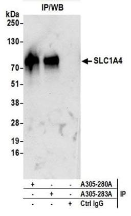 Detection of human SLC1A4 by western blot of immunoprecipitates.