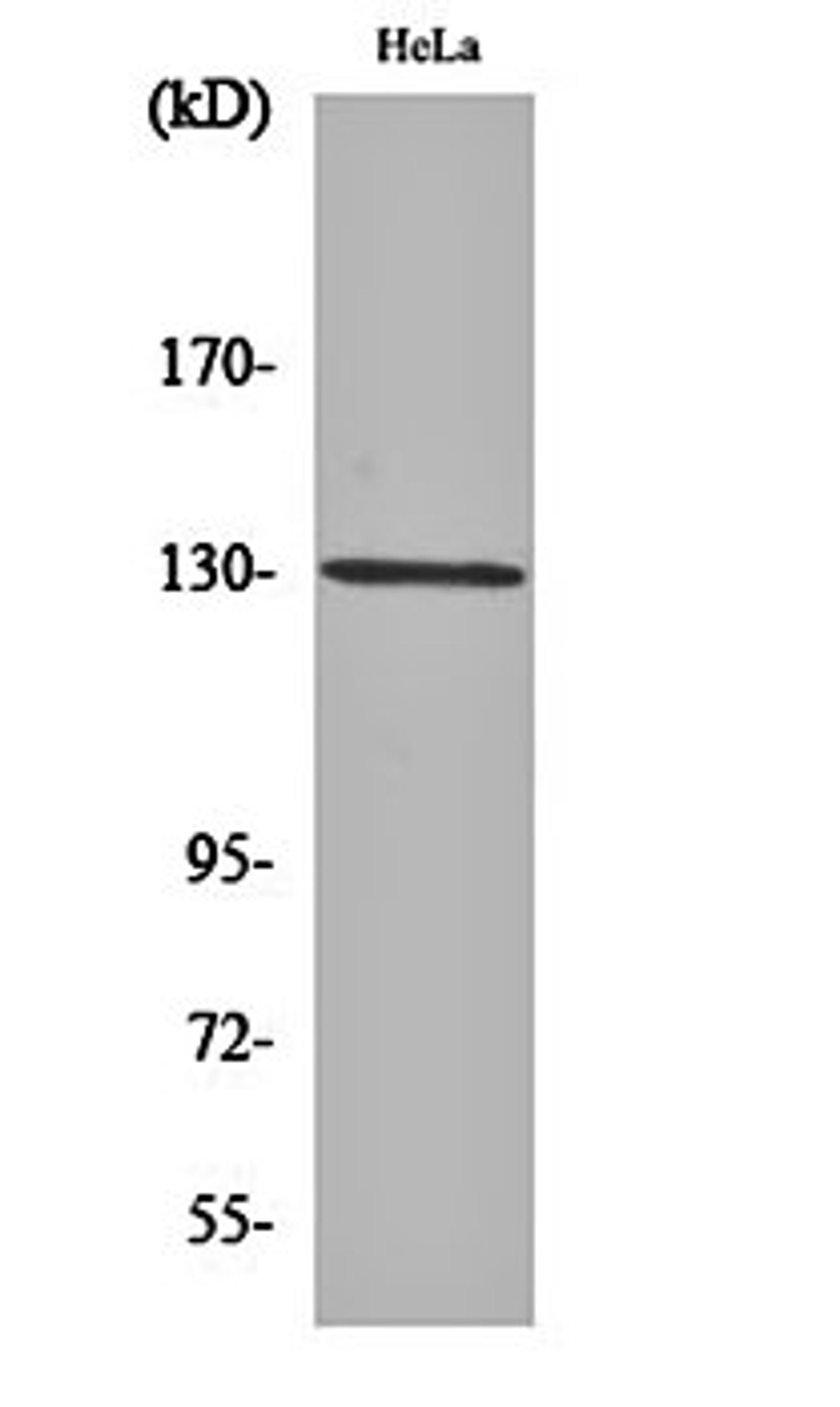 Western blot analysis of Hela cell lysates using LOK antibody