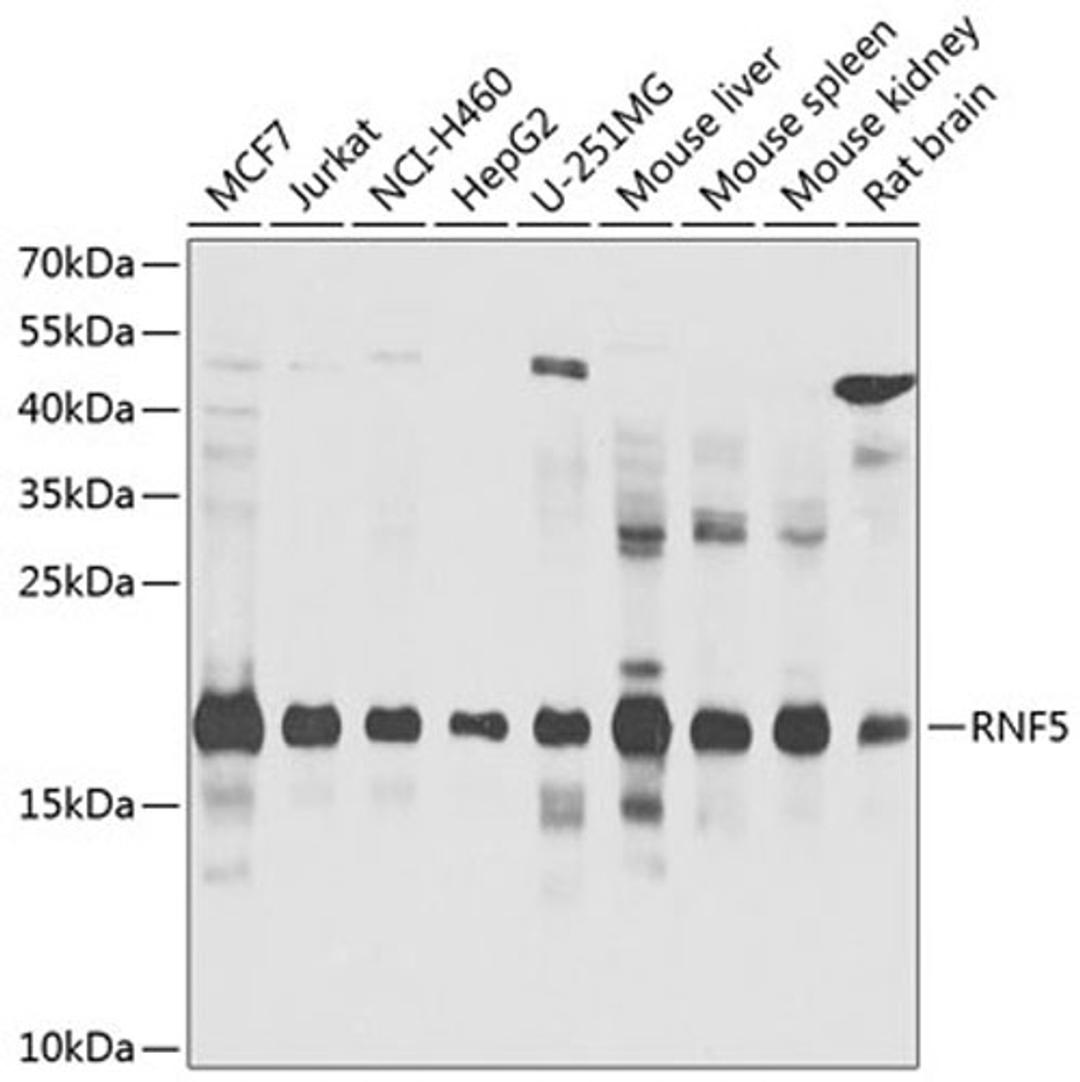 Western blot - RNF5 antibody (A8351)