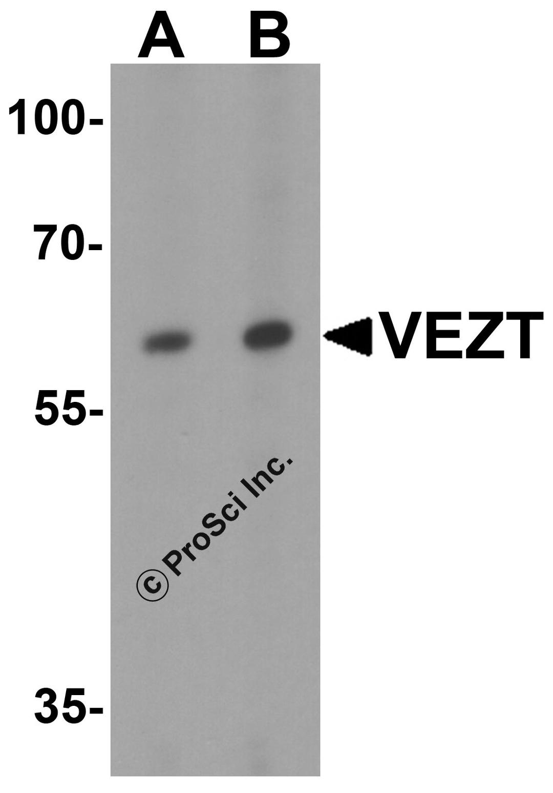 Western blot analysis of VEZT in 293 cell lysate with VEZT antibody at (A) 1 and (B) 2 μg/ml.
