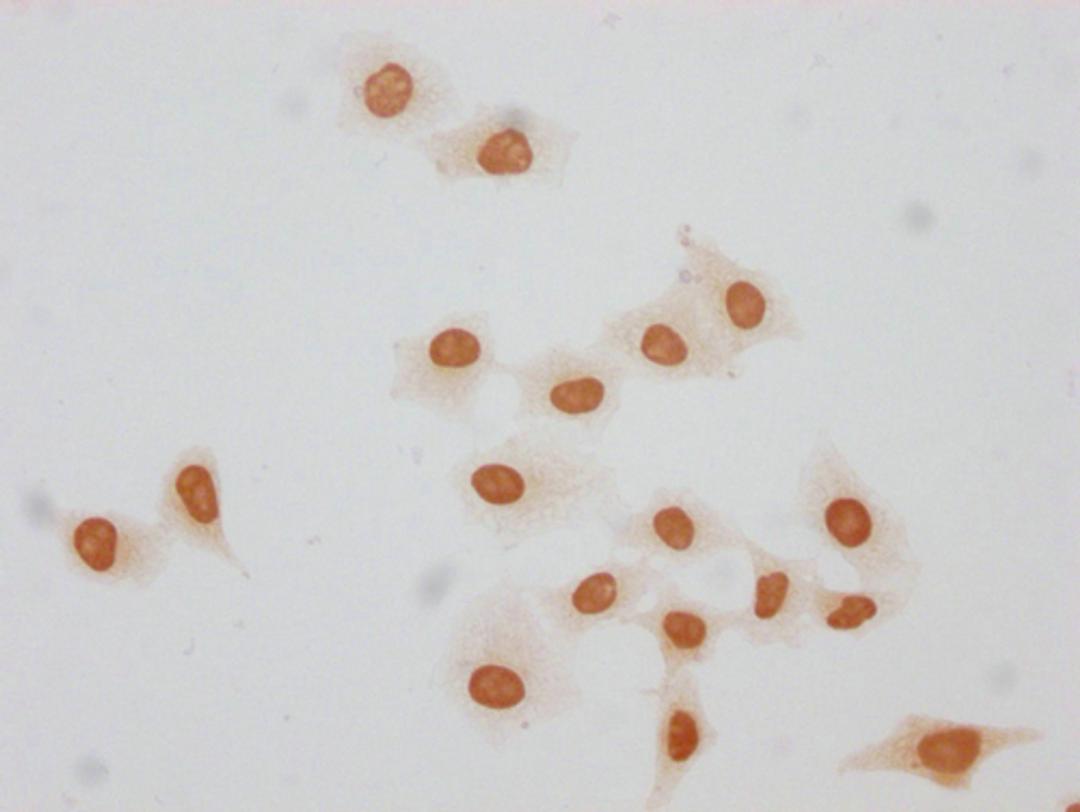 Immunocytochemistry analysis of CSB-PA010379OA140forHU diluted at 1:20 and staining in Hela cells(treated with 30mM sodium butyrate for 4h) performed on a Leica BondTM system. The cells were fixed in 4% formaldehyde, permeabilized using 0.2% Triton X-100 and blocked with 10% normal goat serum 30min at RT. Then primary antibody (1% BSA) was incubated at 4°C overnight. The primary is detected by a biotinylated secondary antibody and visualized using an HRP conjugated SP system.