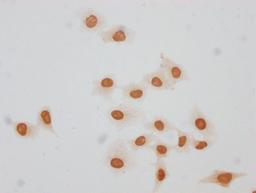 Immunocytochemistry analysis of CSB-PA010379OA140forHU diluted at 1:20 and staining in Hela cells(treated with 30mM sodium butyrate for 4h) performed on a Leica BondTM system. The cells were fixed in 4% formaldehyde, permeabilized using 0.2% Triton X-100 and blocked with 10% normal goat serum 30min at RT. Then primary antibody (1% BSA) was incubated at 4°C overnight. The primary is detected by a biotinylated secondary antibody and visualized using an HRP conjugated SP system.