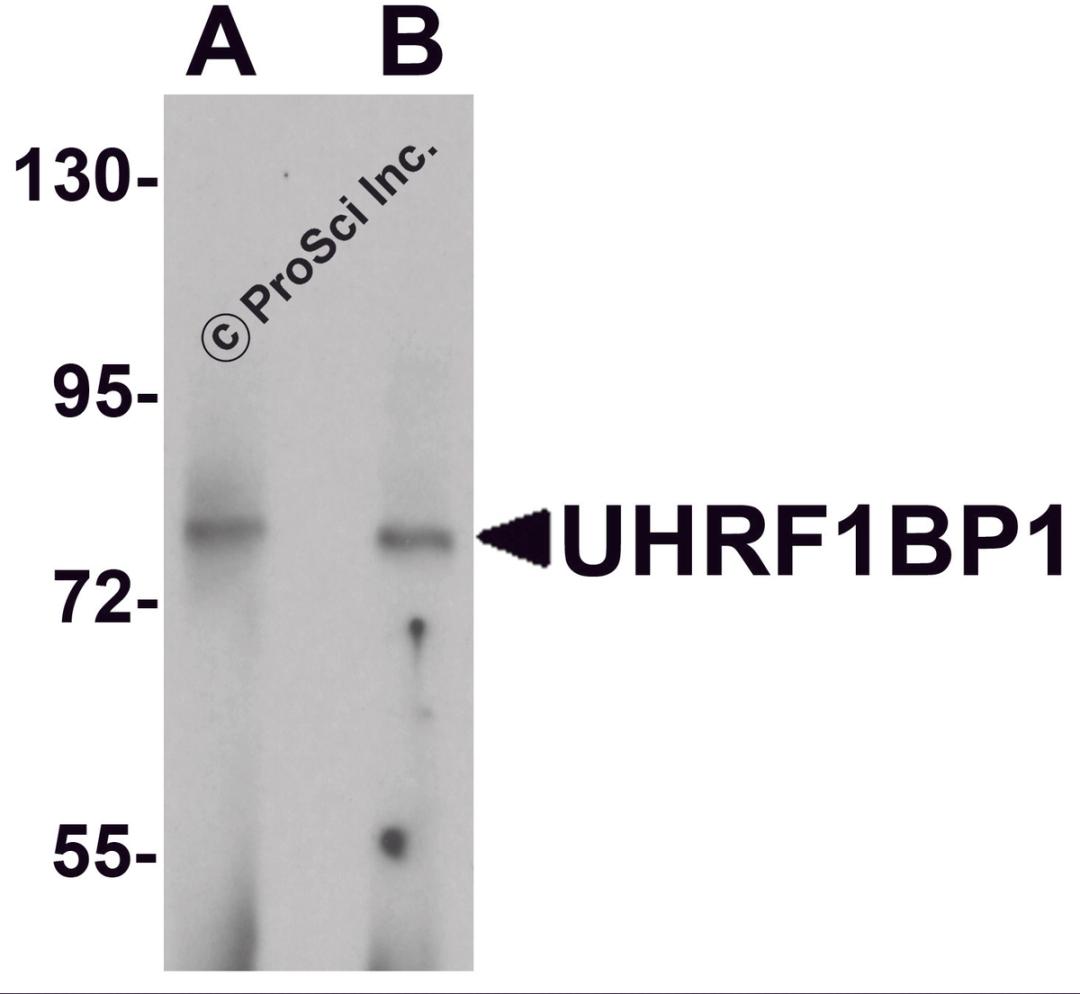 Western blot analysis of UHRF1BP1 in mouse kidney tissue lysate with UHRF1BP1 antibody at (A) 1 and (B) 2 μg/mL.