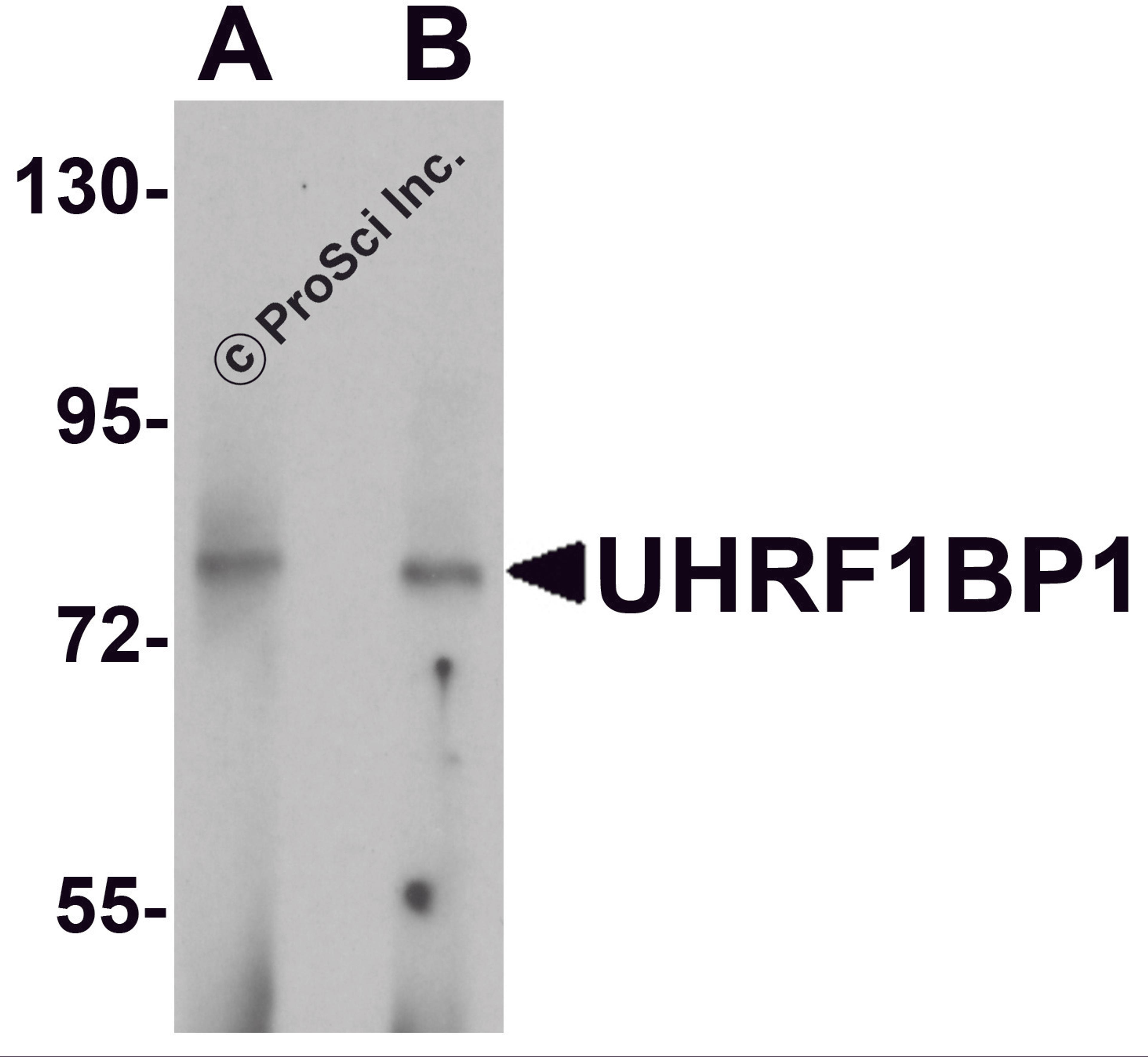 Western blot analysis of UHRF1BP1 in mouse kidney tissue lysate with UHRF1BP1 antibody at (A) 1 and (B) 2 μg/mL.