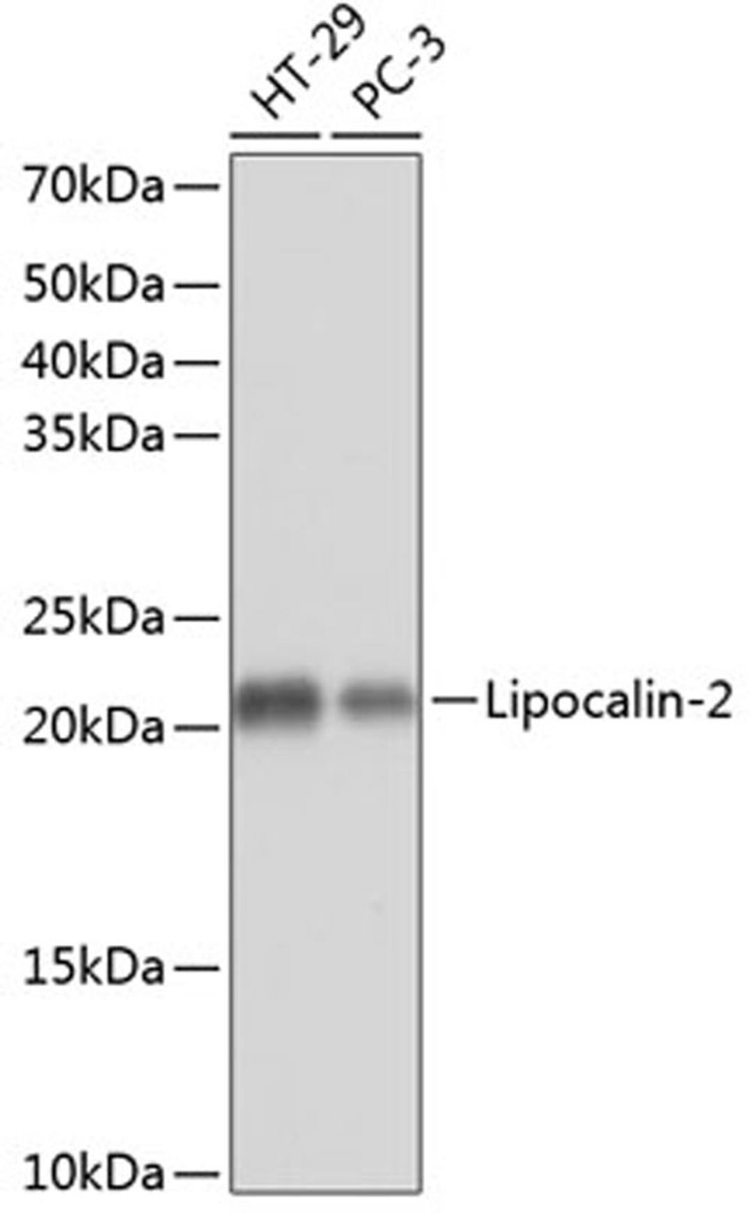 Western blot - Lipocalin-2 Rabbit mAb (A11207)