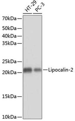 Western blot - Lipocalin-2 Rabbit mAb (A11207)