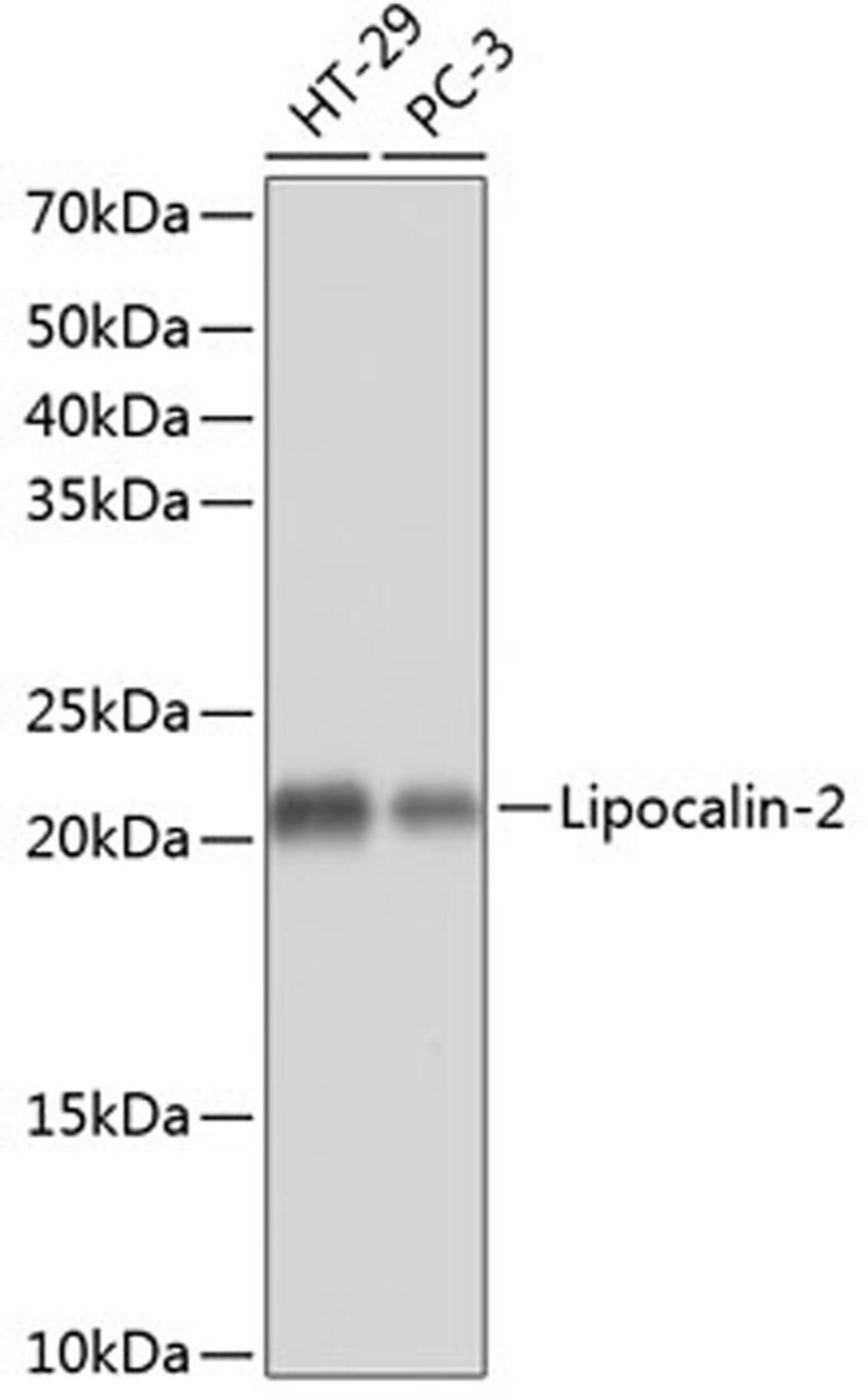 Western blot - Lipocalin-2 Rabbit mAb (A11207)