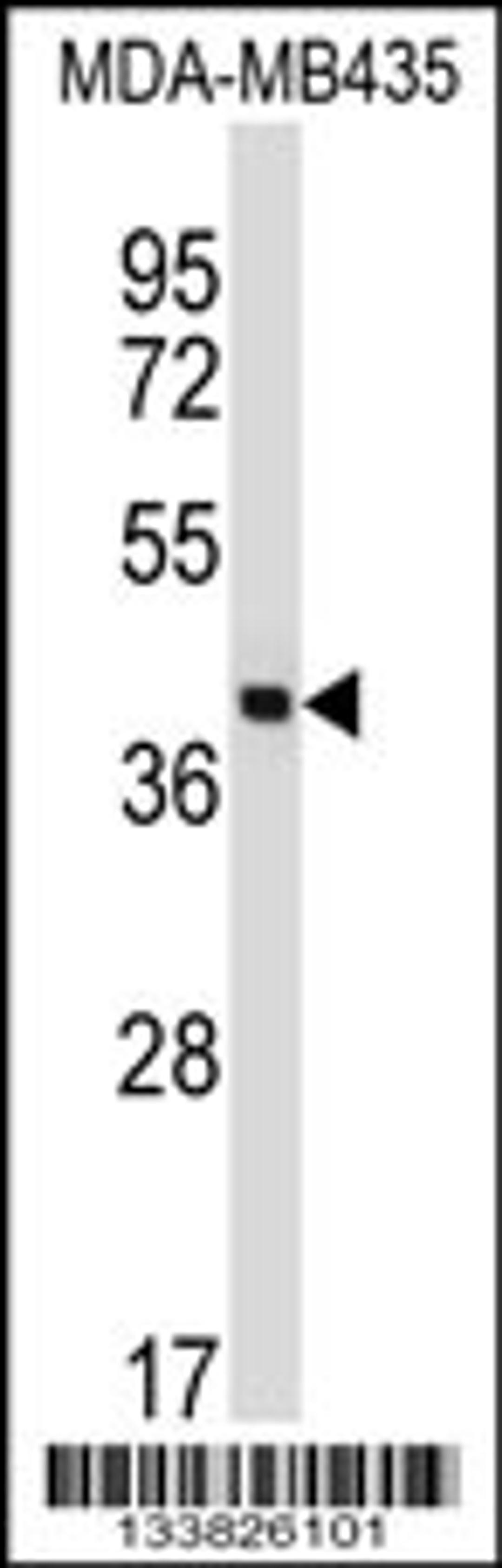 Western blot analysis in MDA-MB435 cell line lysates (35ug/lane).