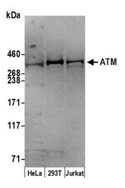 Detection of human ATM by western blot.