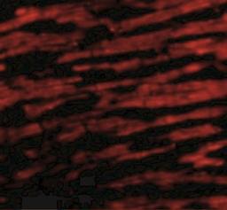 Immunocytochemistry/Immunofluorescence: Bcl rambo Antibody [NBP1-76668] - Immunofluorescence of Bcl-rambo in Human Heart cells with Bcl-rambo antibody at 20 ug/mL.