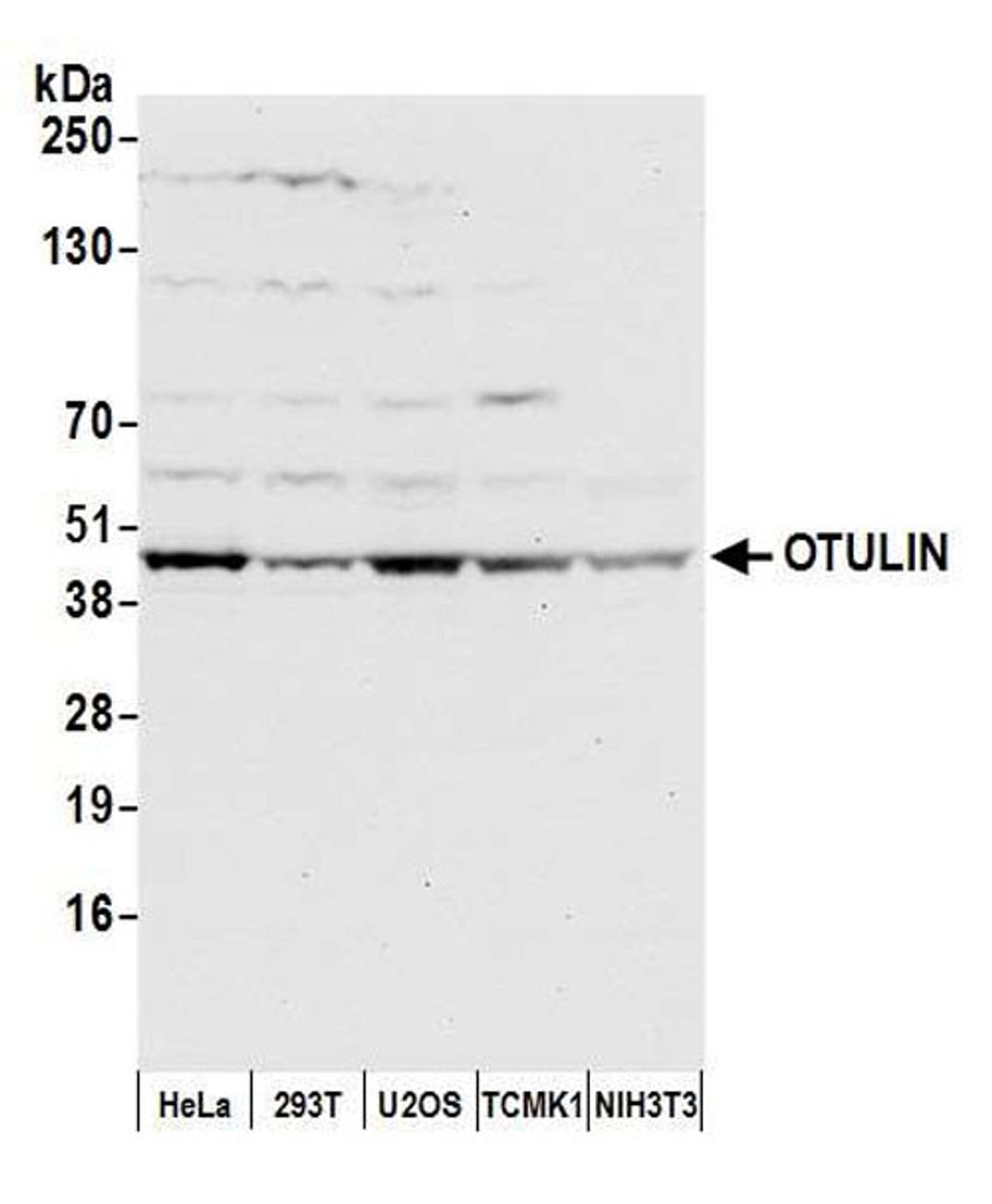 Detection of human and mouse OTULIN by WB.