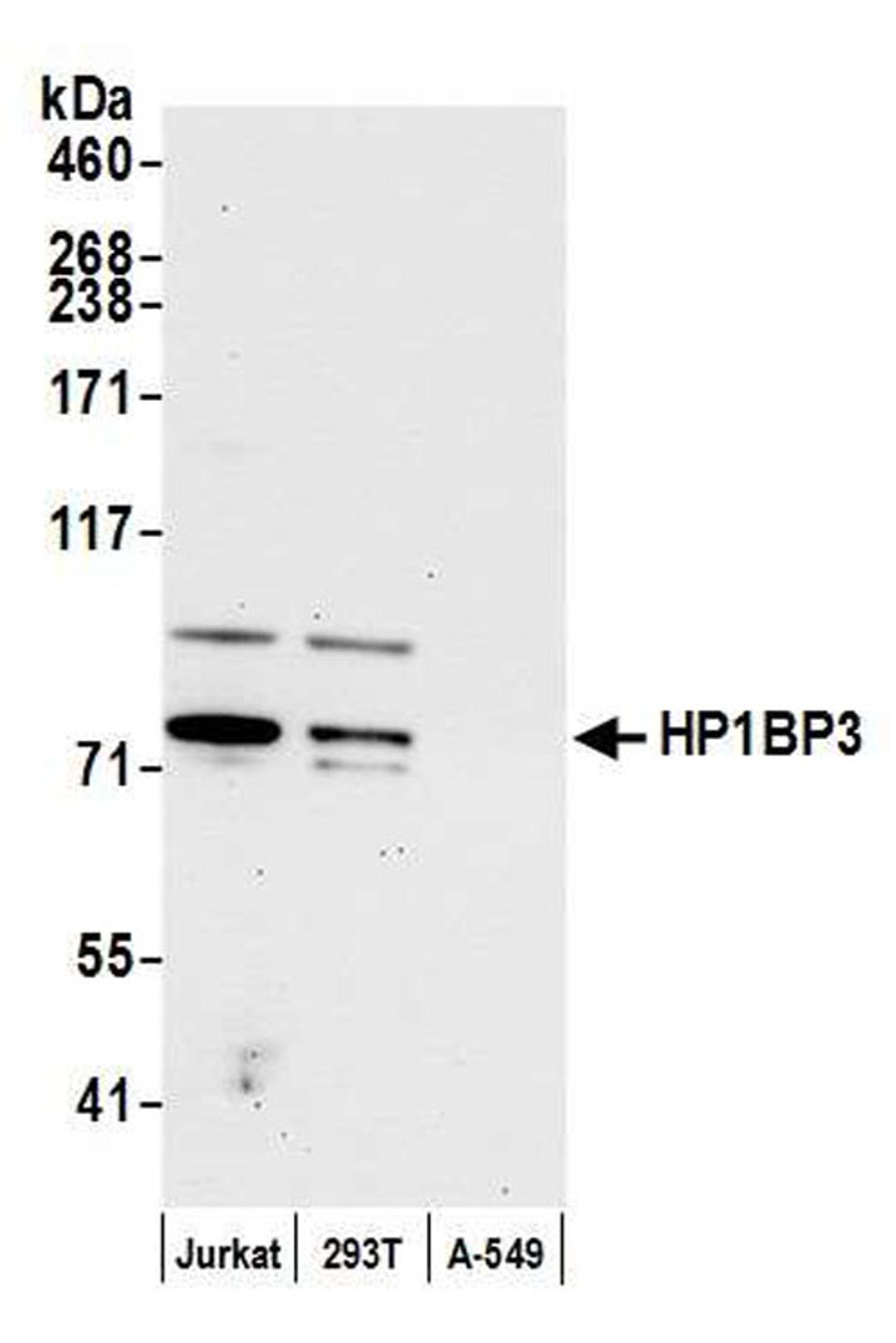 Detection of human HP1BP3 by WB.