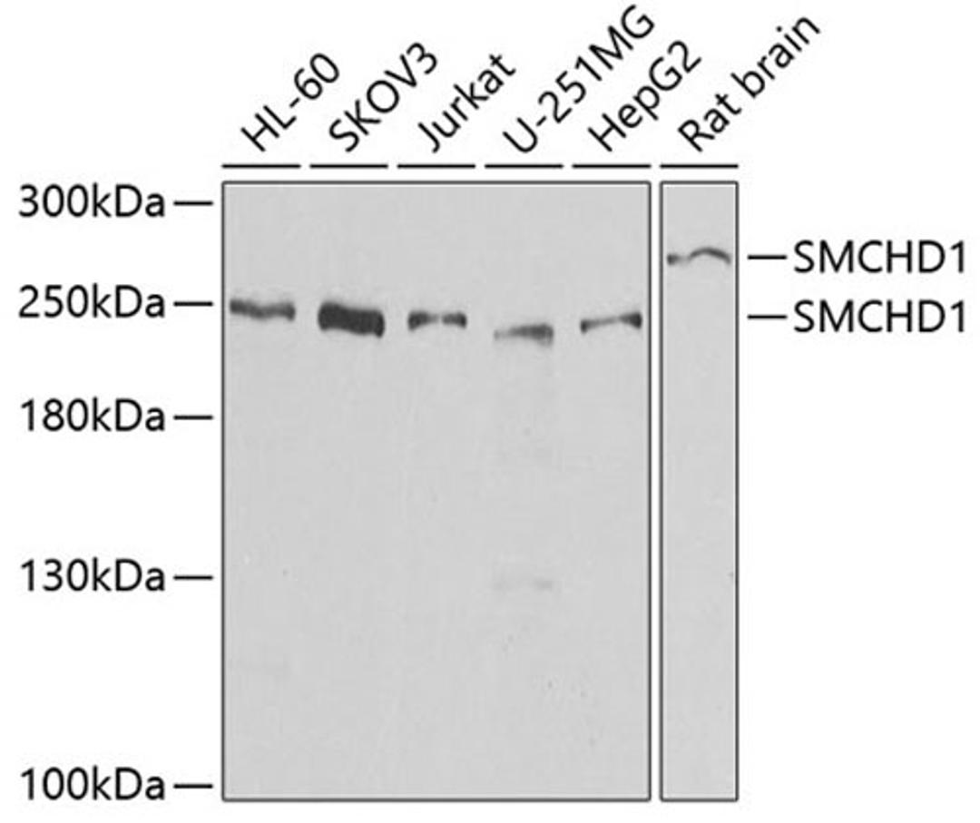 Western blot - SMCHD1 antibody (A7214)