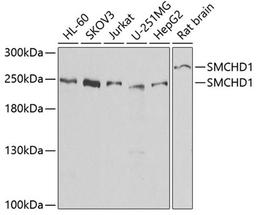 Western blot - SMCHD1 antibody (A7214)