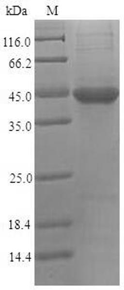 (Tris-Glycine gel) Discontinuous SDS-PAGE (reduced) with 5% enrichment gel and 15% separation gel.