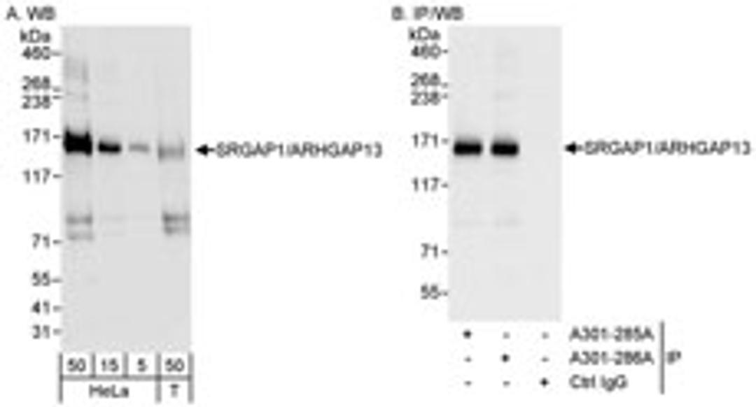 Detection of human SRGAP1/ARHGAP13 by western blot and immunoprecipitation.