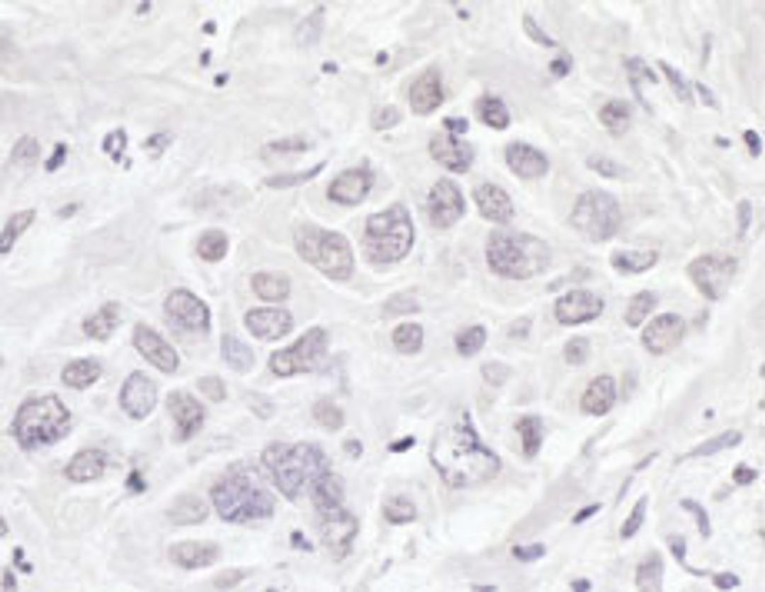 Detection of human BRD3 by immunohistochemistry.