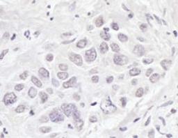 Detection of human BRD3 by immunohistochemistry.