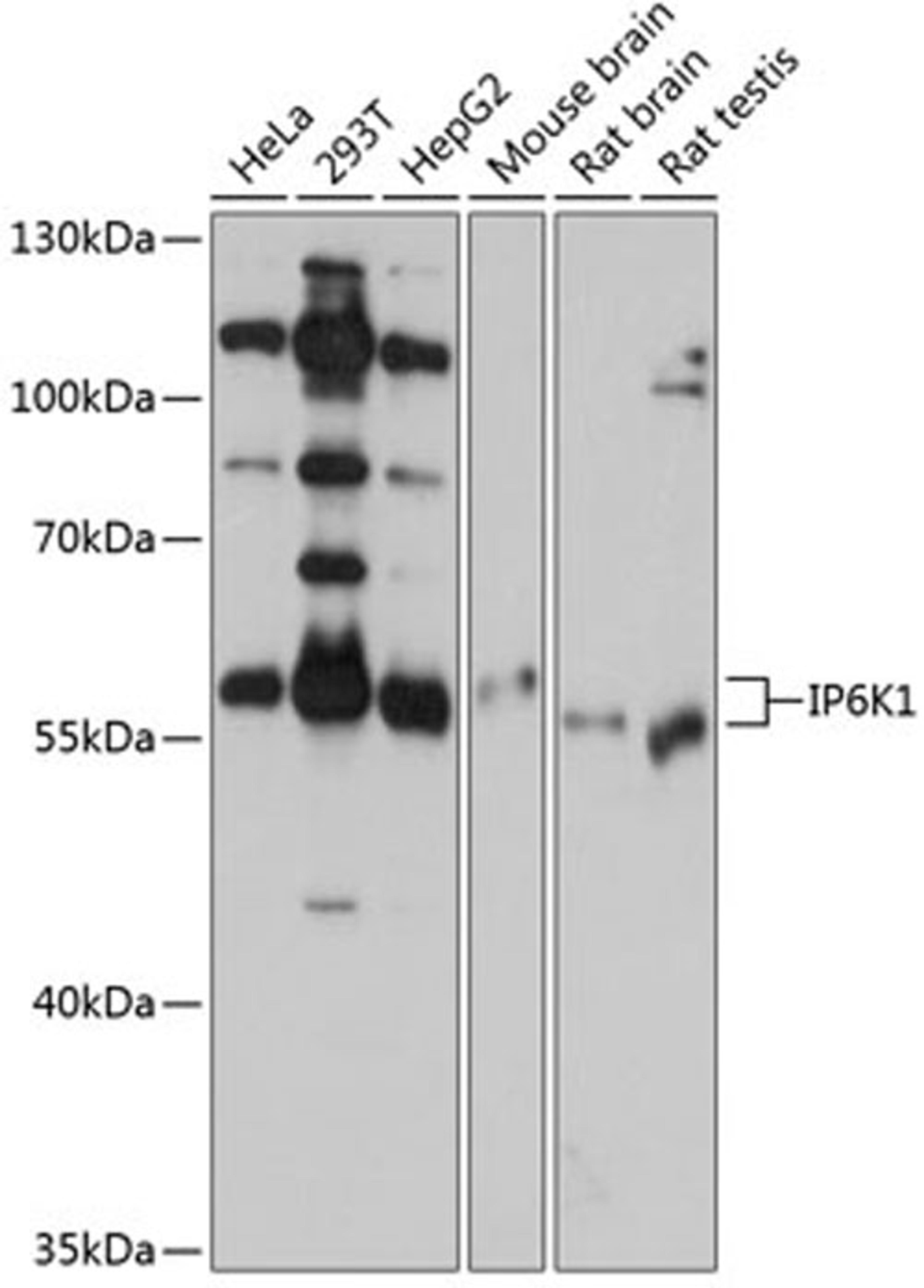 Western blot - IP6K1 antibody (A12216)