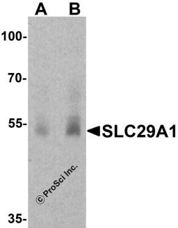 Western blot analysis of SLC29A1 in human ovary tissue lysate with SLC29A1 antibody at (A) 1 and (B) 2 μg/ml.