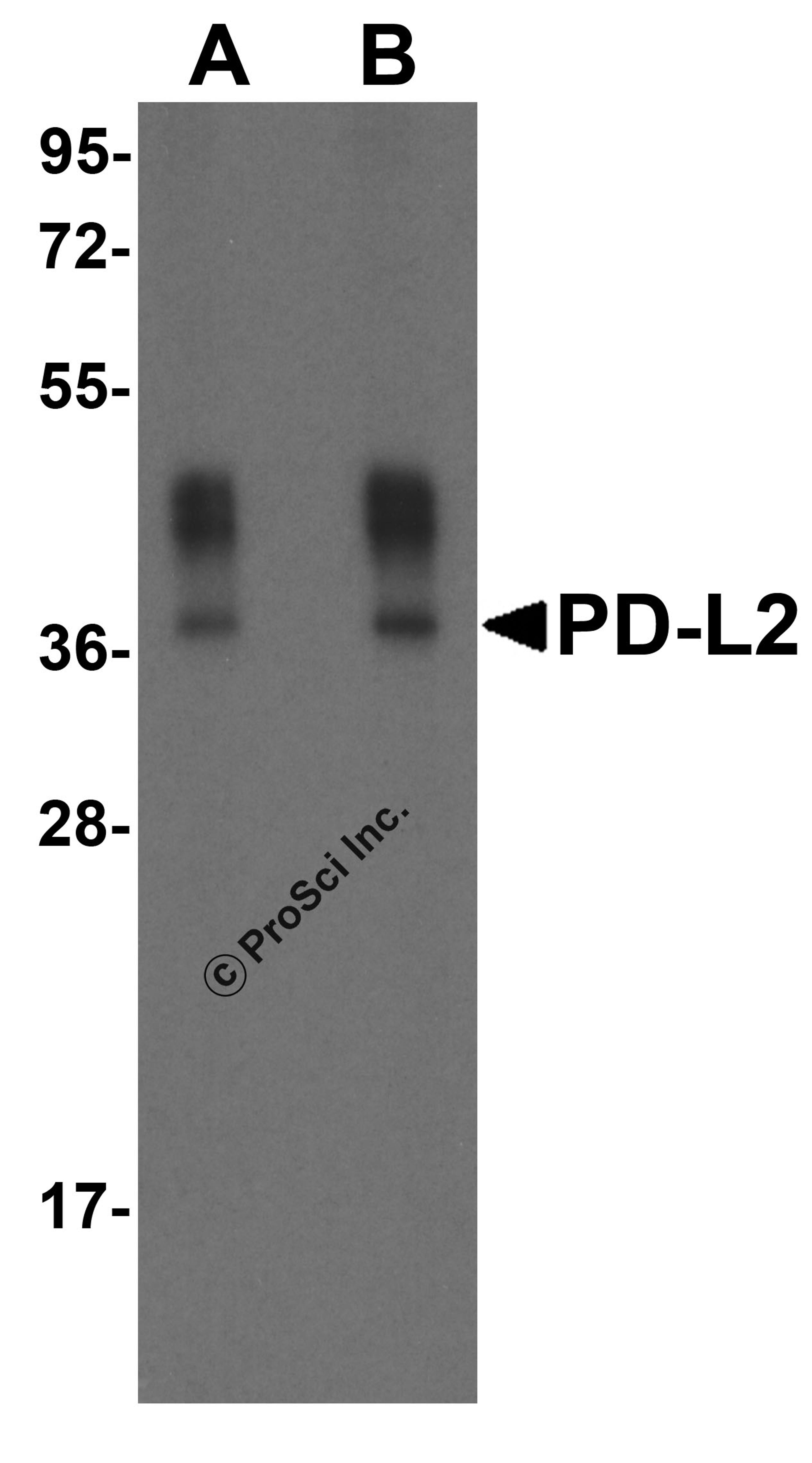 Western blot analysis of PD-L2 in overexpressing HEK293 cells PD-L2 antibody at 0.5 and 1 &#956;g/ml