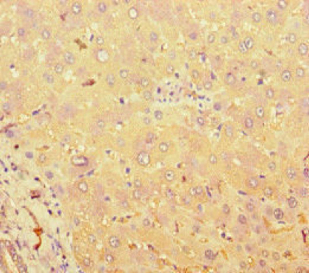 Immunohistochemistry of paraffin-embedded human liver tissue using CSB-PA023155LA01HU at dilution of 1:100
