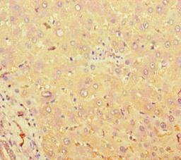 Immunohistochemistry of paraffin-embedded human liver tissue using CSB-PA023155LA01HU at dilution of 1:100