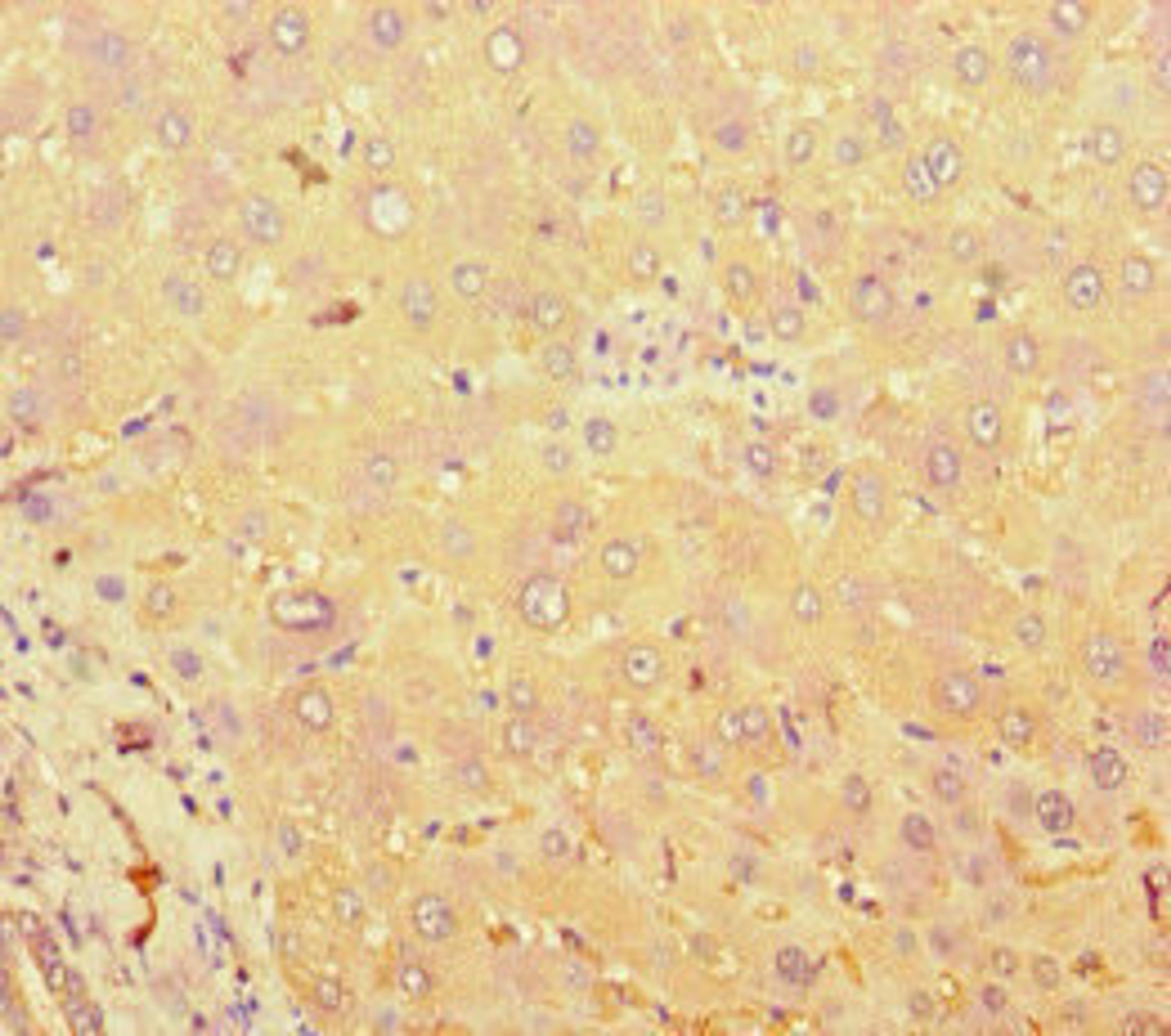 Immunohistochemistry of paraffin-embedded human liver tissue using CSB-PA023155LA01HU at dilution of 1:100