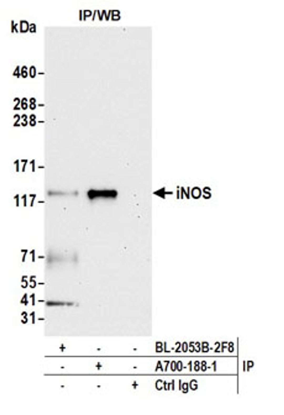 Detection of human iNOS by western blot of immunoprecipitates.