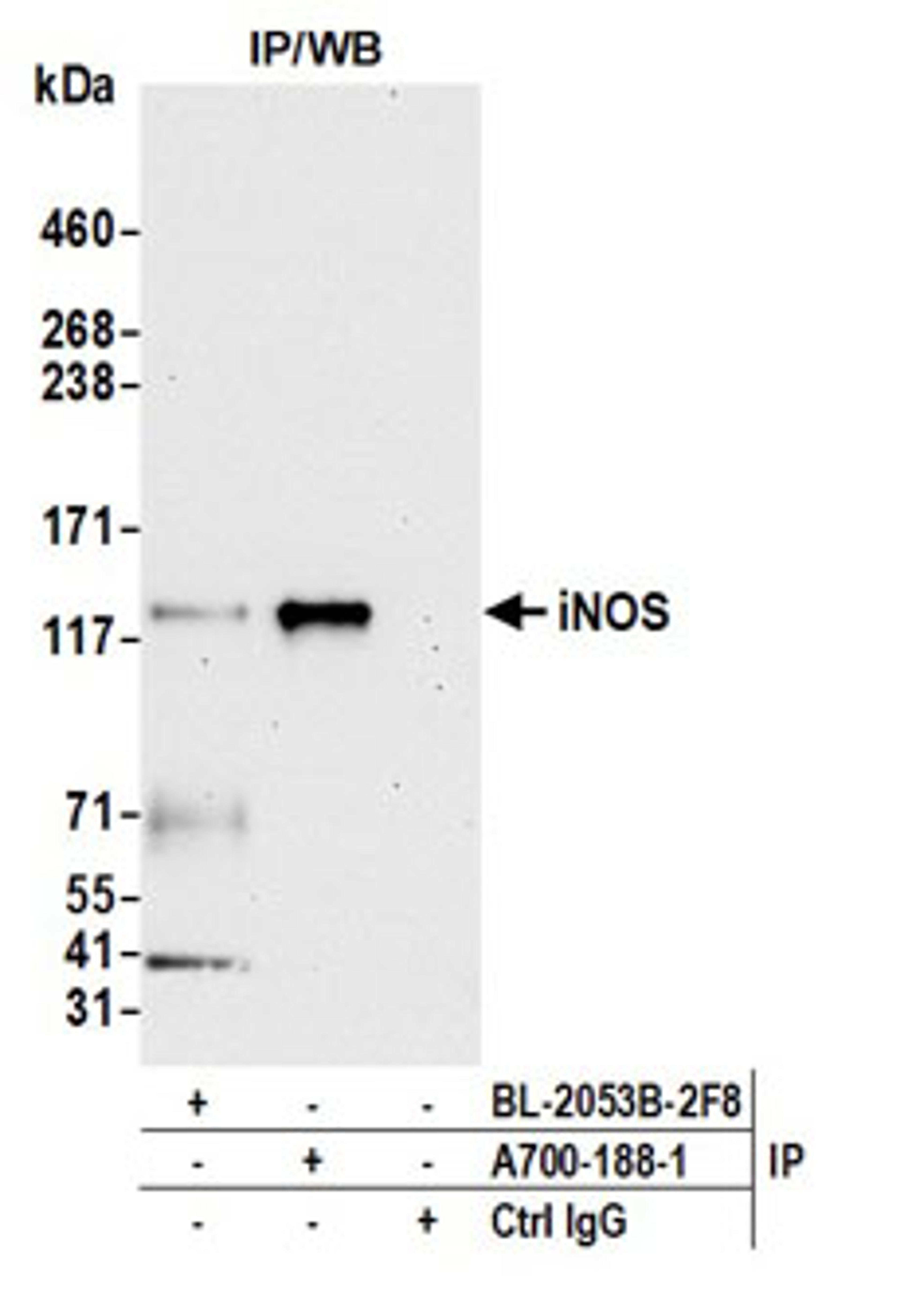 Detection of human iNOS by western blot of immunoprecipitates.