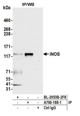 Detection of human iNOS by western blot of immunoprecipitates.