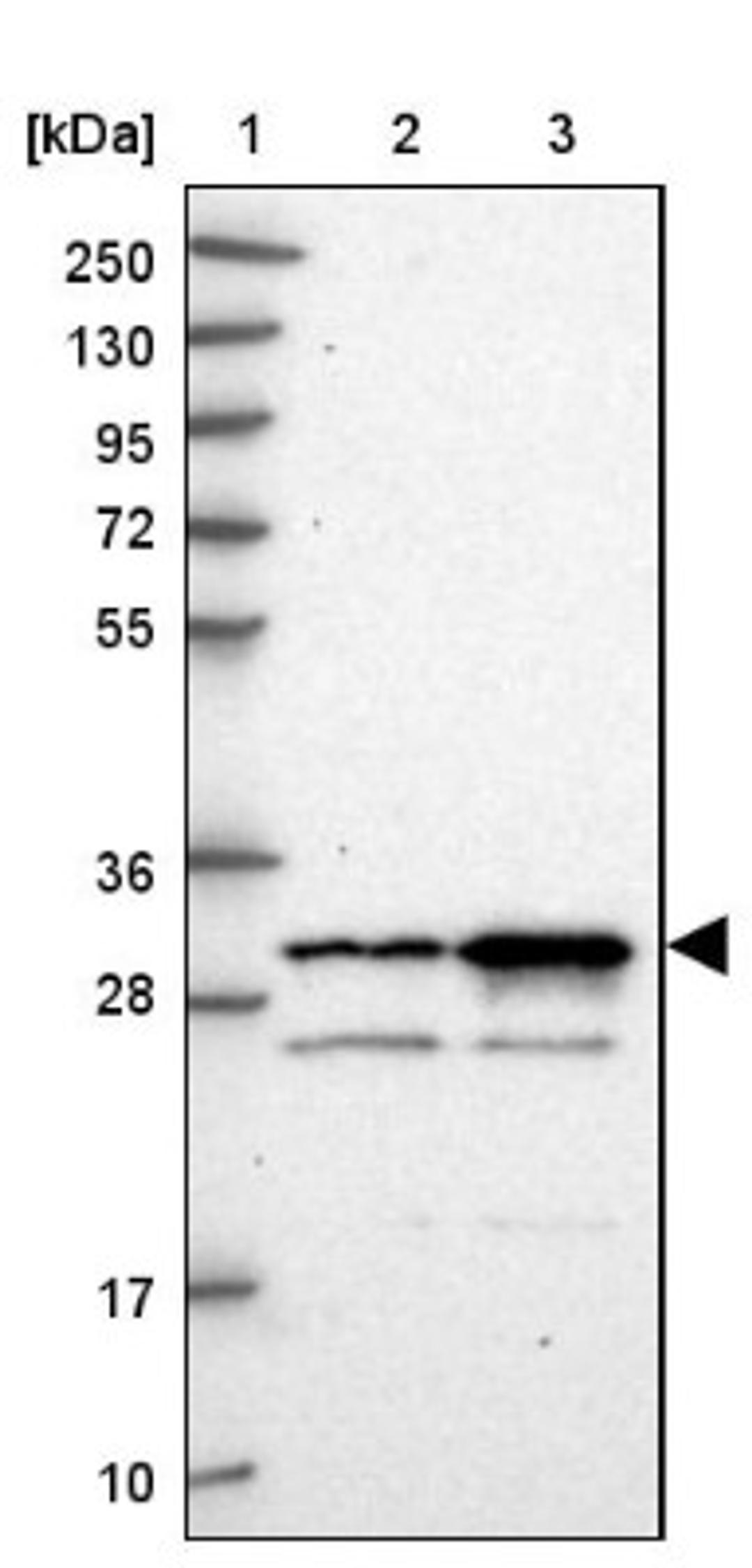 Western Blot: CCDC5 Antibody [NBP1-88159] - Lane 1: Marker [kDa] 250, 130, 95, 72, 55, 36, 28, 17, 10<br/>Lane 2: Human cell line RT-4<br/>Lane 3: Human cell line U-251MG sp