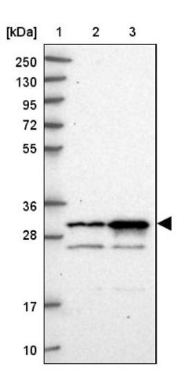 Western Blot: CCDC5 Antibody [NBP1-88159] - Lane 1: Marker [kDa] 250, 130, 95, 72, 55, 36, 28, 17, 10<br/>Lane 2: Human cell line RT-4<br/>Lane 3: Human cell line U-251MG sp